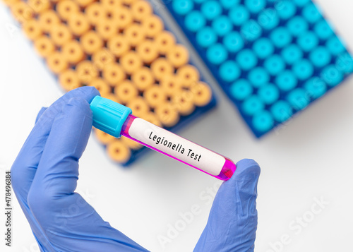 Fotografie Legionella test result with blood sample in test tube on doctor hand in medical