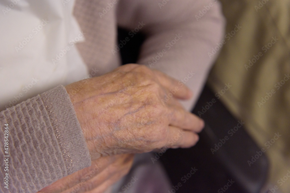 Parkinson's disease. The hand of an elderly woman in the process of movement Parkinson's disease. The hand of an elderly woman in the process of movement