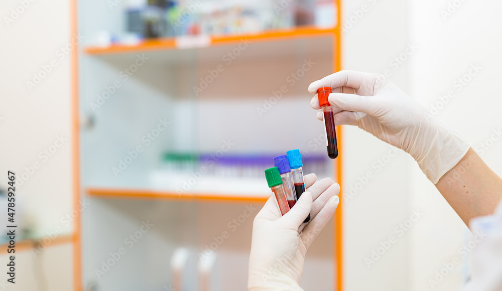 Blood tube in hands. Test for analysis in the laboratory of hematology. Illness diagnosing. Selective focus Blood tube in hands. Test for analysis in the laboratory of hematology. Illness diagnosing. Selective focus
