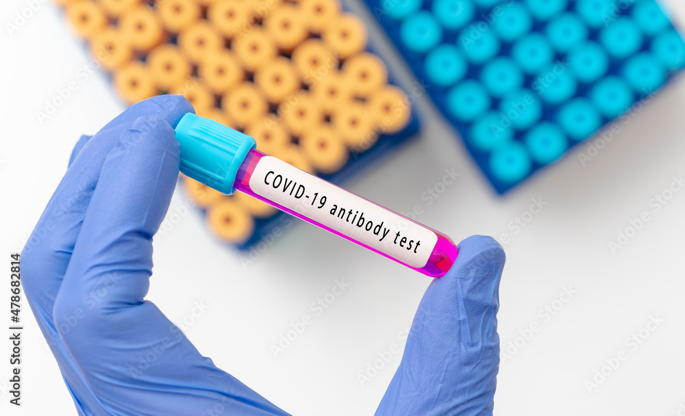 Obraz premium Covid antibody test with blood tubes