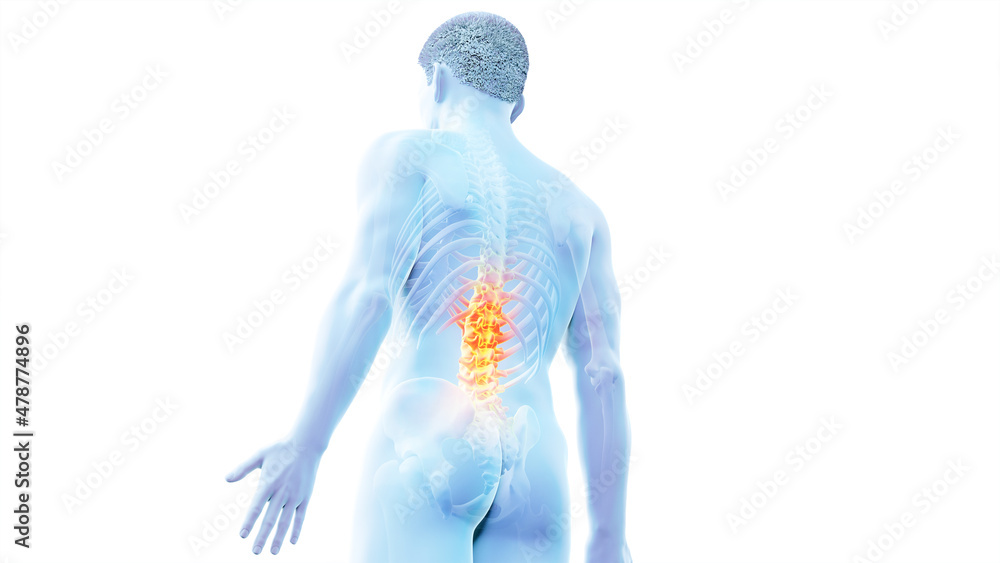 3d rendered illustration of a painful back 3d rendered illustration of a painful back