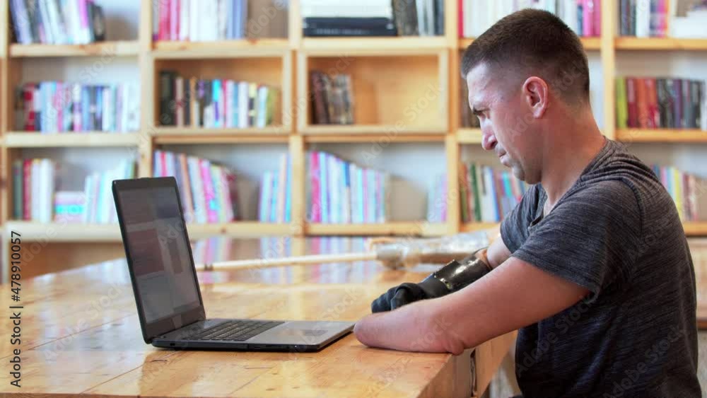 A caucasian man with amputated two stump hands is typing on the laptop using his new modern bionic hand. A man living with a disability is using the laptop in the library A caucasian man with amputated two stump hands is typing on the laptop using his new modern bionic hand. A man living with a disability is using the laptop in the library