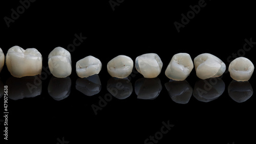 Beautiful close-up photograph of ceramic crowns from ceramics on black background with reflection