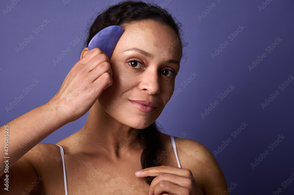 Fototapeta premium Beautiful middle aged woman with vitiligo smiles cutely looking at camera, and holding jade stone massager near her face. Purple background with copy ad space. Dermatology and skin problems concept