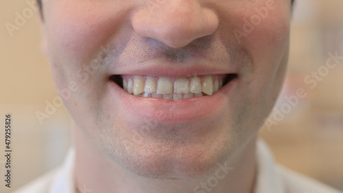 Close up of Smiling Mouth of Young Man