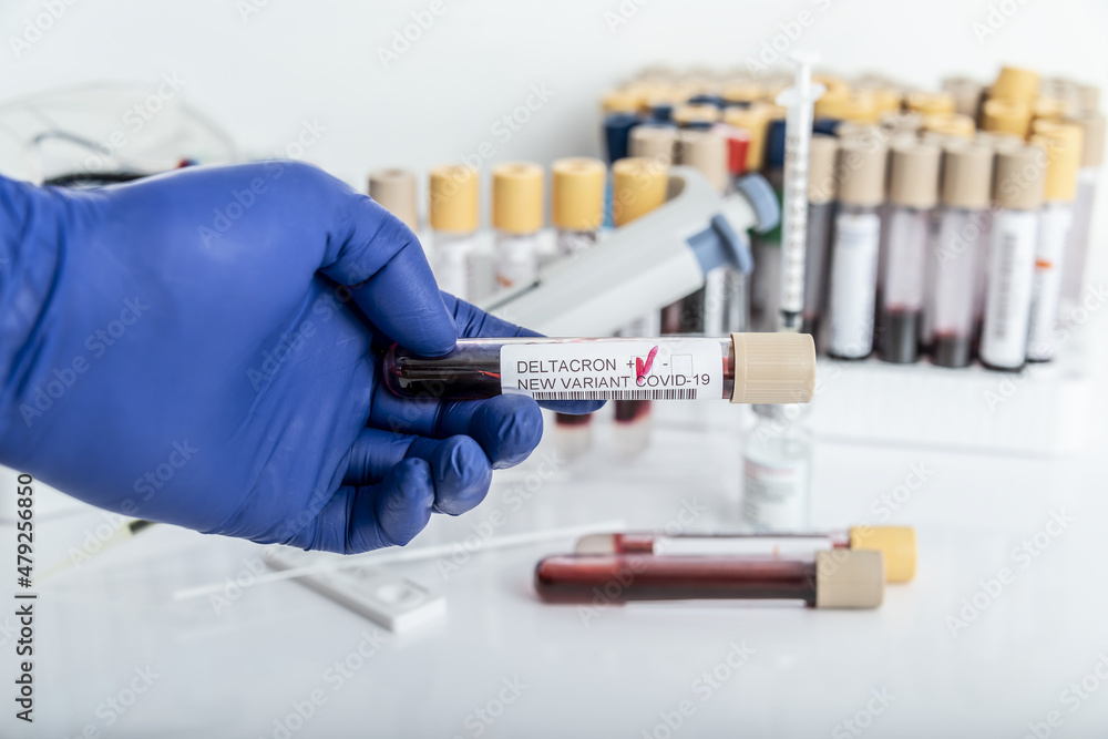 Researcher with blood sample of New Variant of the Covid-19 DELTACRON and generic data of covid-19 Coronavirus Mutations. Doctor in analysis lab holding sample of new strain of covid DELTACRON. Researcher with blood sample of New Variant of the Covid-19 DELTACRON and generic data of covid-19 Coronavirus Mutations. Doctor in analysis lab holding sample of new strain of covid DELTACRON.