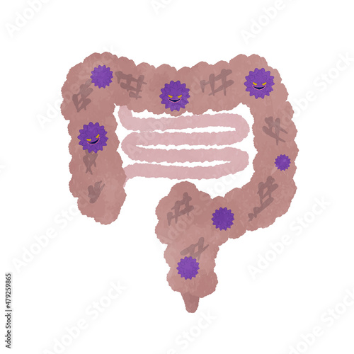Illustration of an unhealthy intestine with bad bacteria