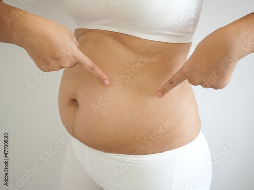 Woman pointing to spots with cellulite overweight female body on white background. closeup photo, blurred. photo