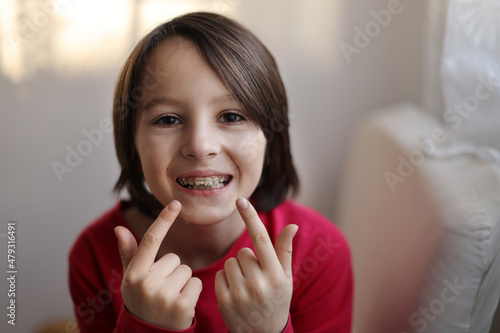 Happy teen with braces photo