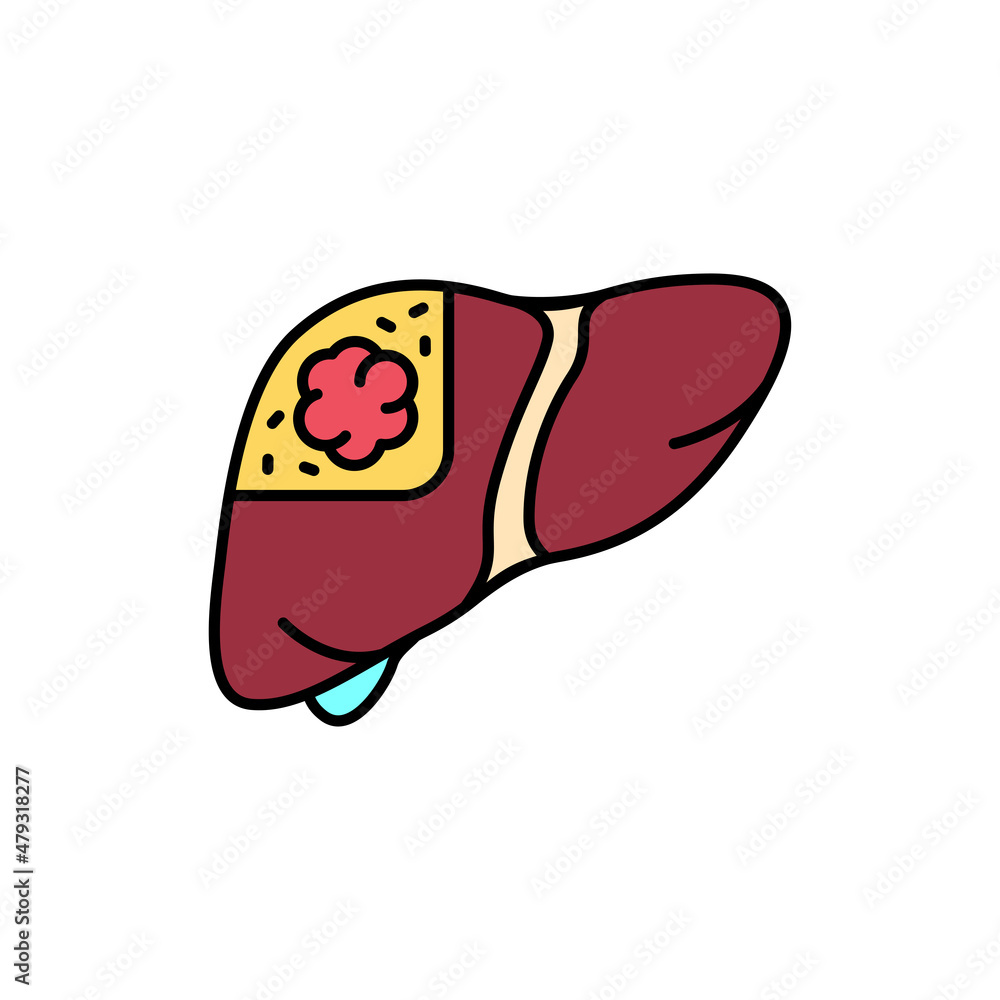 Cancer liver color line icon. Human diseases. Cancer liver color line icon. Human diseases.