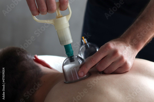 Massage vacuum cups. Close-up of man lying with banks on his back in spa salon. Vacuum jars in treatment and cosmetology. Vacuum therapy. Cup massage.
