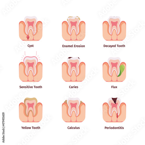 Dental problems. Different oral bacteria teeth drawings common bad fillings garish vector infographics medical concept illustrations