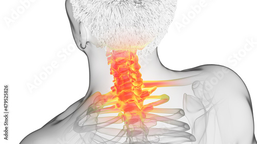 3d rendered illustration of a painful cervical spine photo