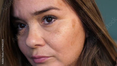 Woman with sun damage on her face. This middle-aged woman has sun spots, sun damage, liver spots on her face.  photo