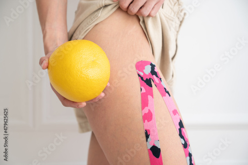 Woman holding grapefruit and showiing problem zone. Aesthetic taping procedure to eliminate cellulite. Weight loss photo