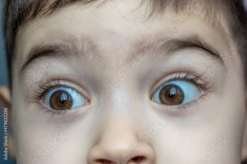 Fotografía a surprised kid eyes