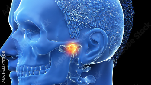3d rendered illustration of a painful temporomandibular joint photo