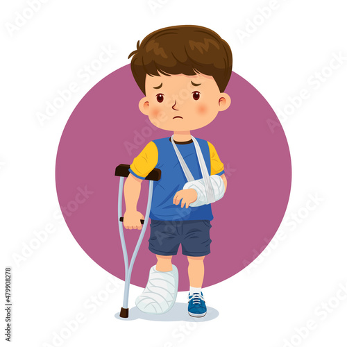 Little boy injured a broken arm and leg, had to be cast, and used on crutches. Vector illustration