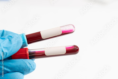 Two Test tube with empty label  to biological sample for medical laboratory research on white background