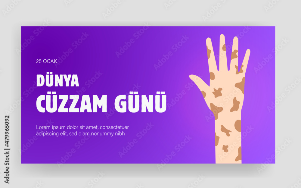 Fototapeta premium Dünya Cüzzam Günü Translation: world leprosy day 25 january. World Leprosy Day Symbol for Social Media Template Banner
