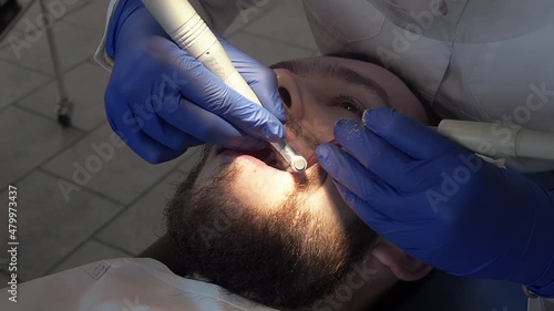 Woman professional doctor dentist applies a special paste to the teeth of a patient in a dental clinic. Hygiene care for oral cavity. Prophylactic cleaning of teeth in stomatology clinic