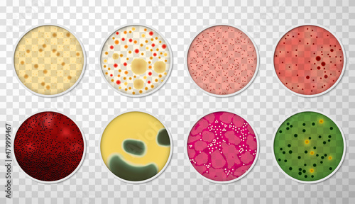 Canvas Petri dishes with bacteria and germs colonies set top view realistic vector micr