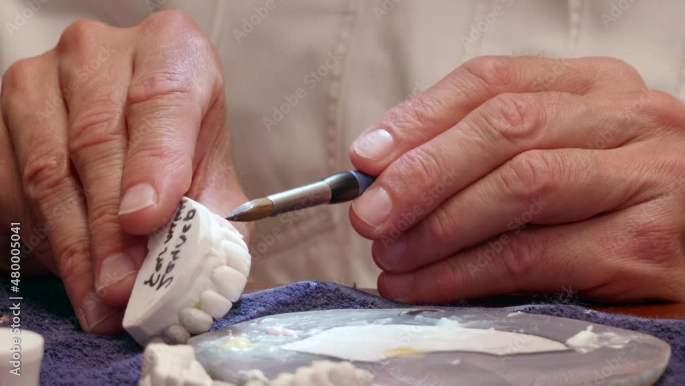 Tracking Close Shot Dental Specialist Working on Implant Prosthetics Tracking Close Shot Dental Specialist Working on Implant Prosthetics