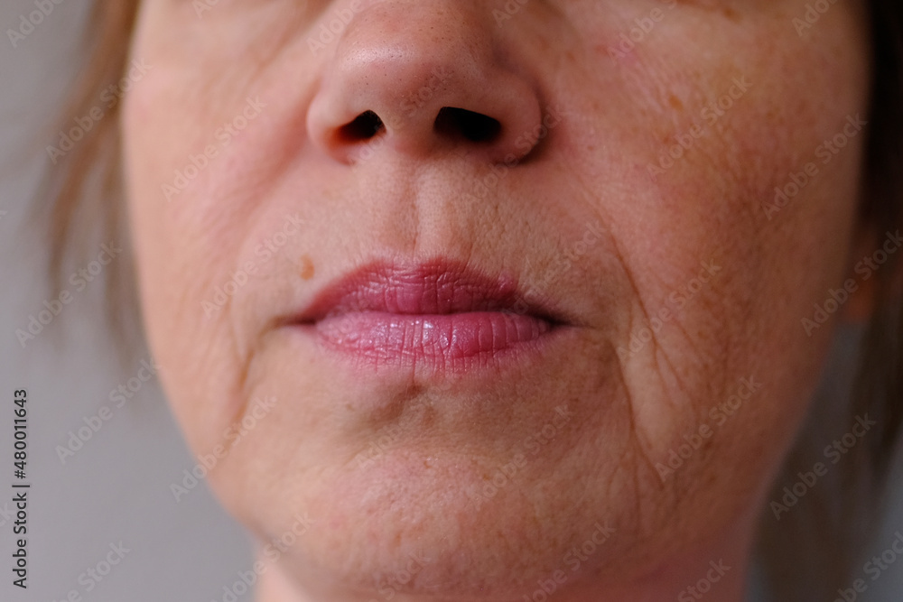 Fototapeta premium close-up part of female face of woman 40-50 years old with age wrinkles, wart over lip, concept of cosmetics, skincare, correction surgery, beauty and perfect skin, flyer for your ad antiaging