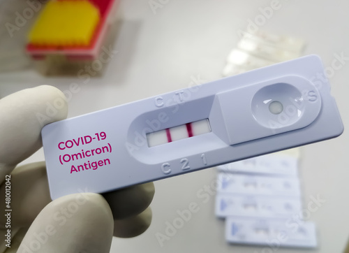 Coronavirus Covid-19 laboratory test result that shows Positive result of Omicron variant.