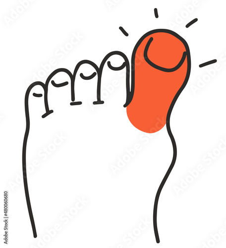 Pain and redness in big toe with gout. symptom disease Doodle vector illustration.