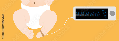 Newborn pulse oximetry monitoring. Sensor placed in the foot of a newborn and the oximeter shows the spo2 and PR  photo