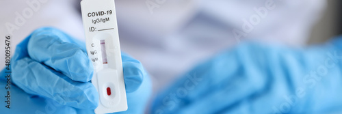 Fotografering Doctor wearing disposable gloves holds positive PCR test for coronavirus infecti