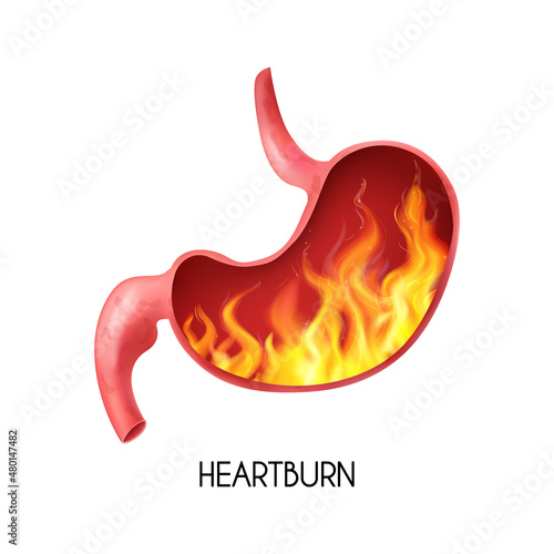 Realistic Stomach Illustration
