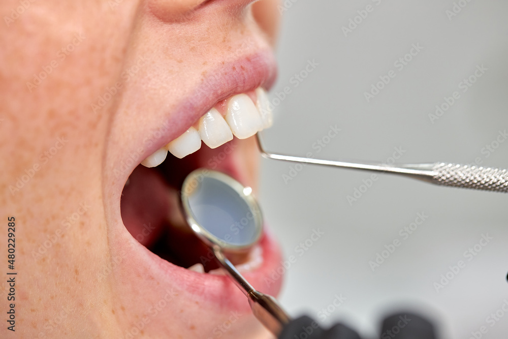 stomatologist examining female patient's teeth, close up photo, corpped face. checkup in detal clinic by professional, using tools instruments in doctor's cabinet. copy space - obrazy, fototapety, plakaty 