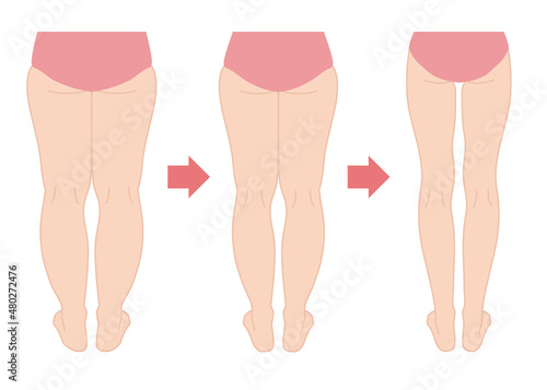 ダイエットの経過　脚やせ（背面）
