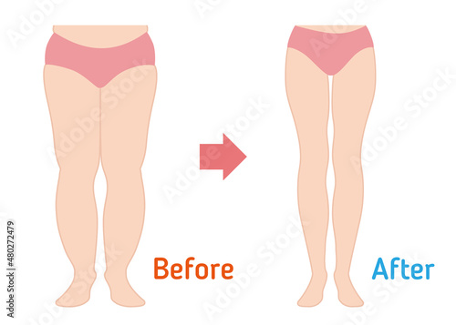 ダイエット　ビフォーアフター（脚やせ）
