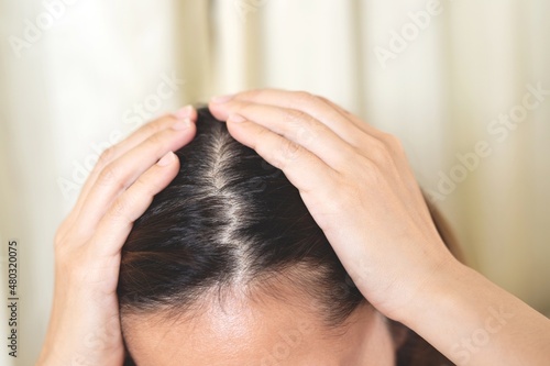 scalp from dandruff It is a common condition that causes the skin on your scalp to peel off.