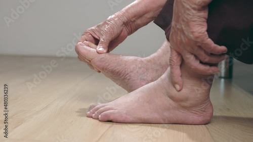 Elderly woman massage swollen feet.