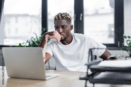 serious african american man with vitiligo thinking near blurred laptop in office. photo