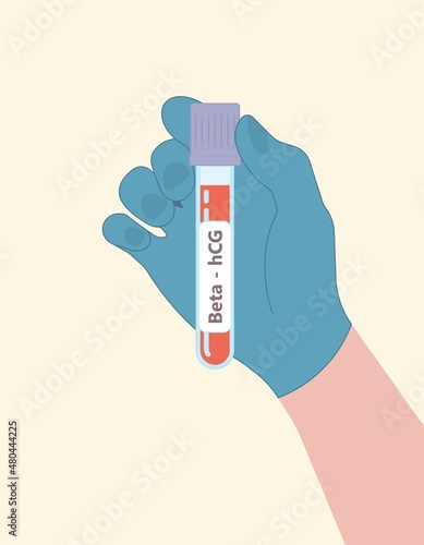 Beta hCG levels blood test at home period of days false result weeks cycle twins missed miscarry lab past In vitro fertilisation IVF sperm baby check egg line molar loss serum care menstruation birth