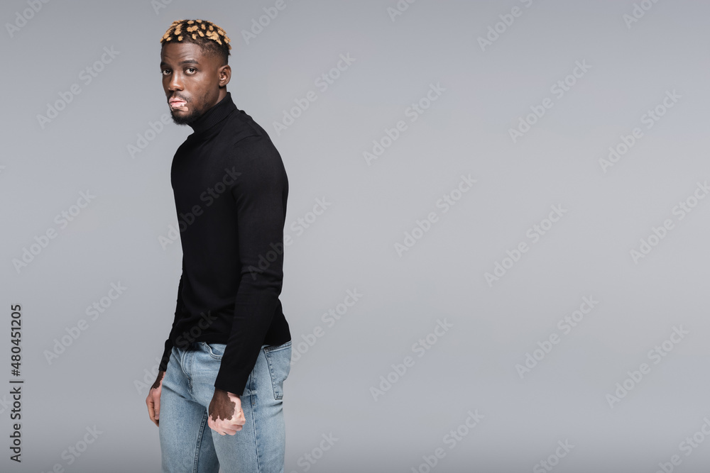 Fototapeta premium african american man with vitiligo and trendy hairstyle posing in jeans and black turtleneck isolated on grey.