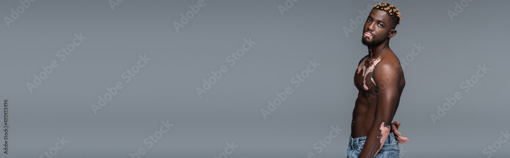 Fototapeta premium young african american man with vitiligo skin and muscular torso looking at camera isolated on grey, banner.