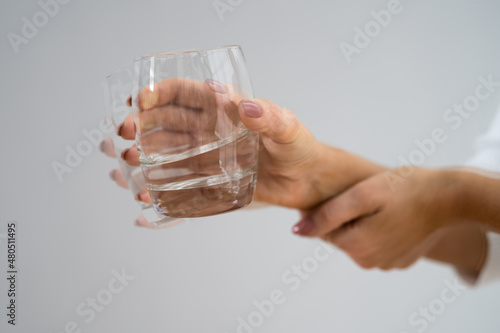 Person Hand With Dystonia photo