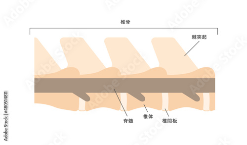 椎間板,図解,イラスト,ベクター,インフォグラフィック,グラフィック,説明,病気,病院,原因,症状,椎間板ヘルニア,腰痛,ついかんばん,骨,模型