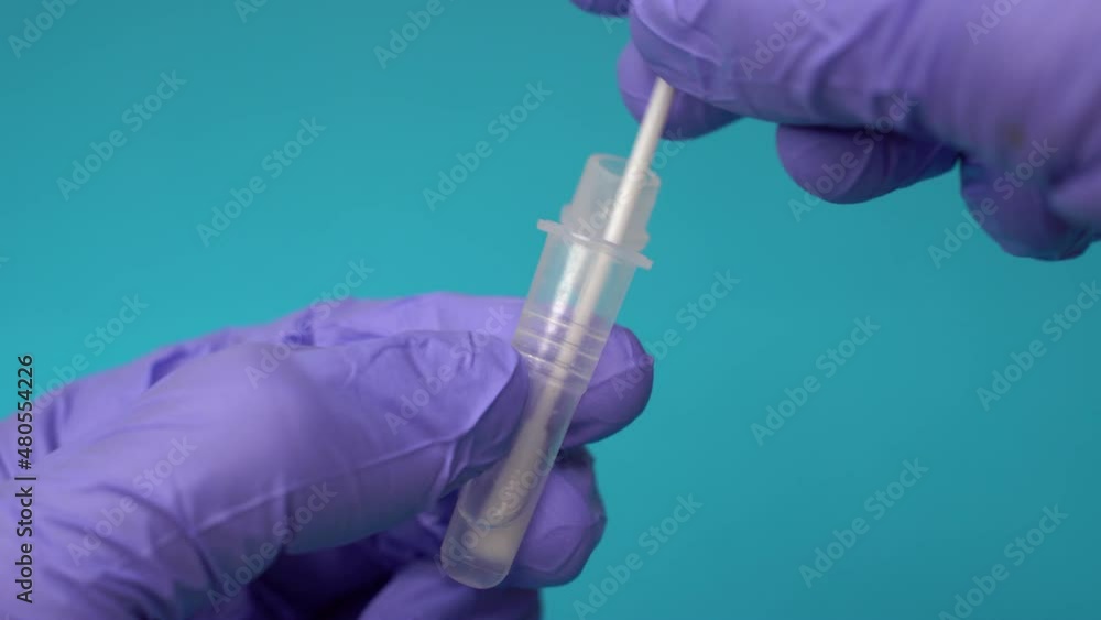 Doctor or nurse insertig a swab into an extraction tube, in the process of a antigen test Doctor or nurse insertig a swab into an extraction tube, in the process of a antigen test