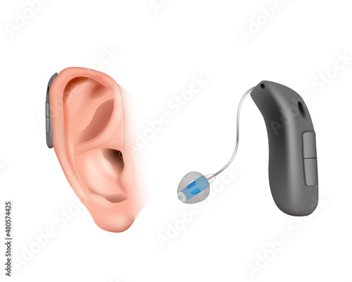 BTE divices with an external receiver. Hearing aid behind the ear. Treatment and prosthetics in otolaryngology. Realistic Vector illustration