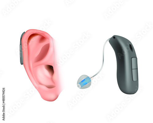 BTE divices with an external receiver. Hearing aid behind the ear. Treatment and prosthetics in otolaryngology. Deafness and hearing loss.  Realistic Vector illustration