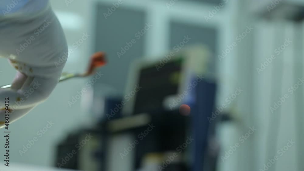 Team surgeon at work in operating room. Modern equipment in operating room. Medical devices for neurosurgery Team surgeon at work in operating room. Modern equipment in operating room. Medical devices for neurosurgery