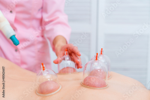 Woman is receiving canning treatment at spa. Cupping therapy. Treatment used in traditional chinese medicine for pain relief and other health benefits. Alternative medicine