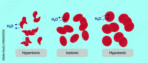 Human cell osmosis. Hemoglobin in a isotonic, hypertonic and Hypotonic illustration 
